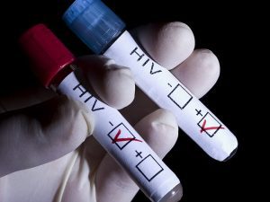 High risk groups should get tested for HIV.